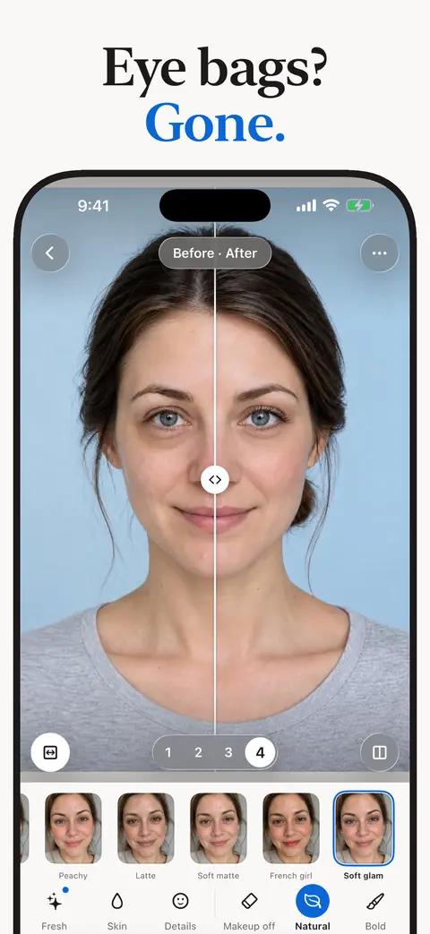 Before and after of softened eye bags, captioned Eye bags? Gone.